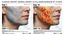 The 28-Day Structural Reset: Analyzing Cellular Transformation under VISIA